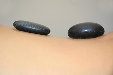 Girl's back with hot stones for massage.