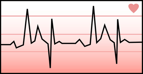 Electrocardiogramme