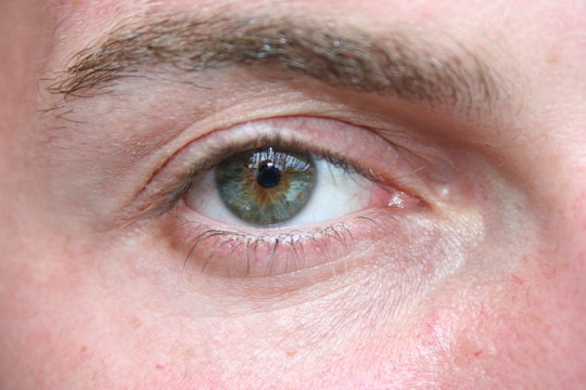 occhio verde