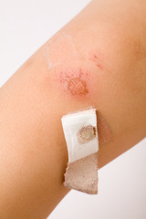 leg wound and Bandage close up
