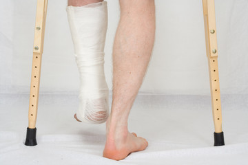 The person with plaster on a foot stands on a floor