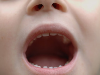 Boy with open mouth