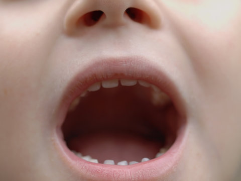 Boy With Open Mouth