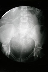 X-ray of pregnant woman