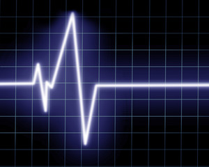 Heart beat on clinic monitor