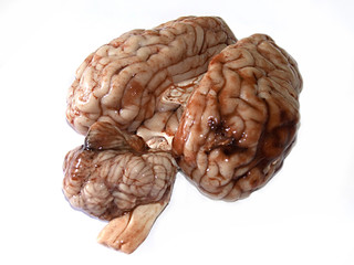 Brain
