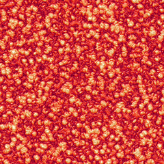 Bacteria culture under microscope