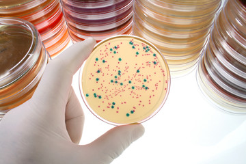 Petri dishes for medical research