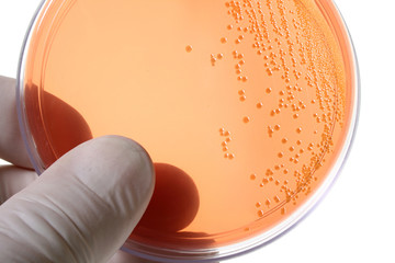 Petri dishes for medical research - 4614448