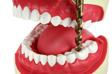 Drilling  a tooth