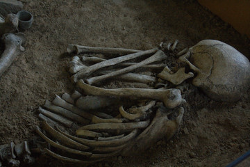 schädel, knochen, anatomie, skelett