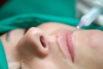 Close-up cosmetic lip treatment with syringe injection