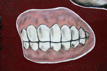 dientes postizos