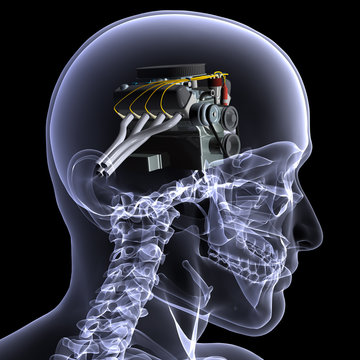 Skeleton X-Ray - Motorhead 1