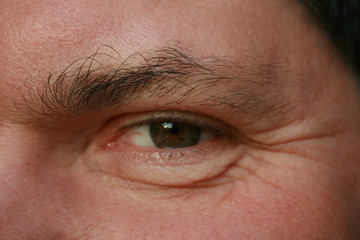 Auge