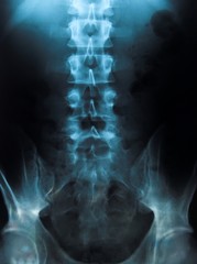 x-ray of a young male spine