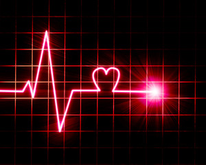 Heart beat as recorded on monitor