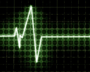 Heart beat on clinic monitor