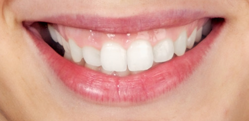 a photography of a beautiful mouth woman smiling