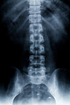  body x-ray photo