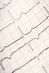electrocardiogram - closeup