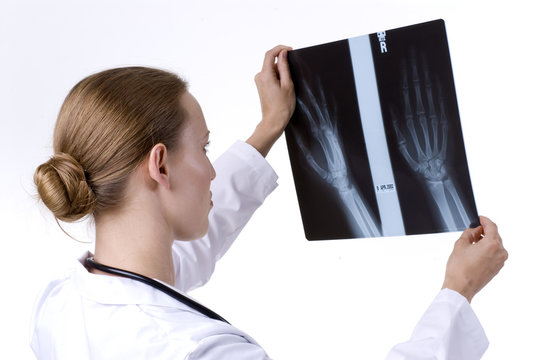 Female Doctor Checking an X-Ray