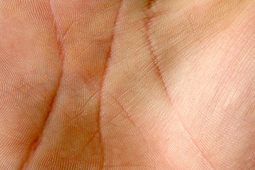 Human hand skin