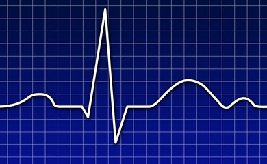 EKG, Herz, Kardiogramm