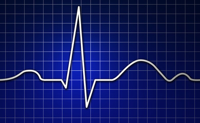 EKG, Herz, Kardiogramm