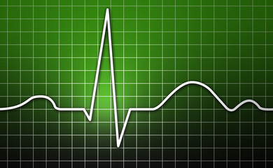 EKG, Herz, Kardiogramm
