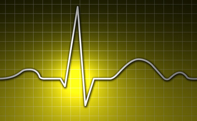 EKG, Herz, Kardiogramm