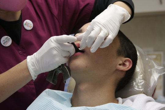 teenager in the dentist's chair after braces are removed 