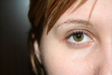 Eye