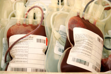 Details shot of platelet concentrate, Human blood in storage