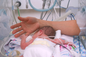 Hand of the physician and newborn in incubator - obrazy, fototapety, plakaty