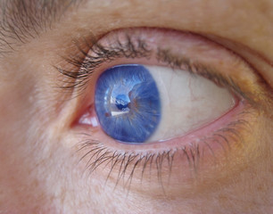 Blue eye with contact lens in