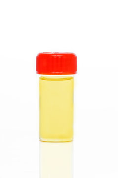 flacon d'urine