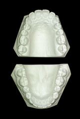 Gypsum model plaster of tooth - Upper View