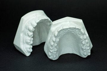 Gypsum model plaster of tooth  © Sunlove