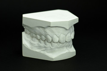 Gypsum model plaster of tooth - Side view