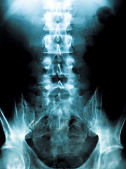 x-ray of a young male spine