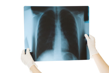 Doctor examining x-ray scans