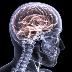 Skeleton X-Ray - Brain 1