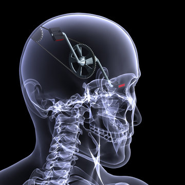 Skeleton X-Ray - Exercise Your Mind