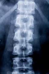 x-ray image