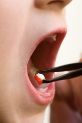 Obraz premium Tooth removal