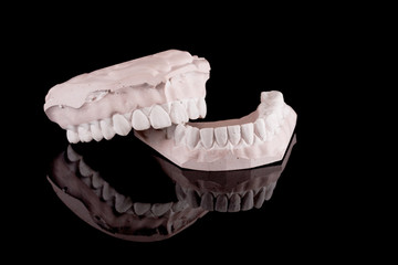 gypsum model of a human teeth on black background