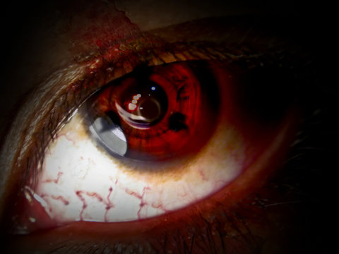 Red Sore Eyes
