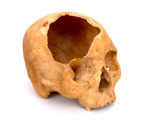 skull