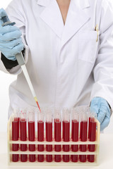 Scientist using pipette to extract samples